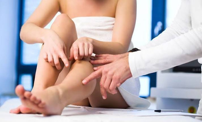 Як зрозуміти, коли час звернутися до флеболога?